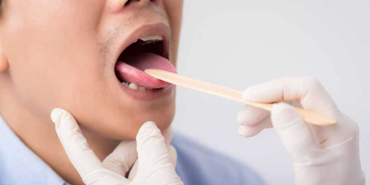 How to Choose the Best Hospital for Oral Cancer Surgery in India