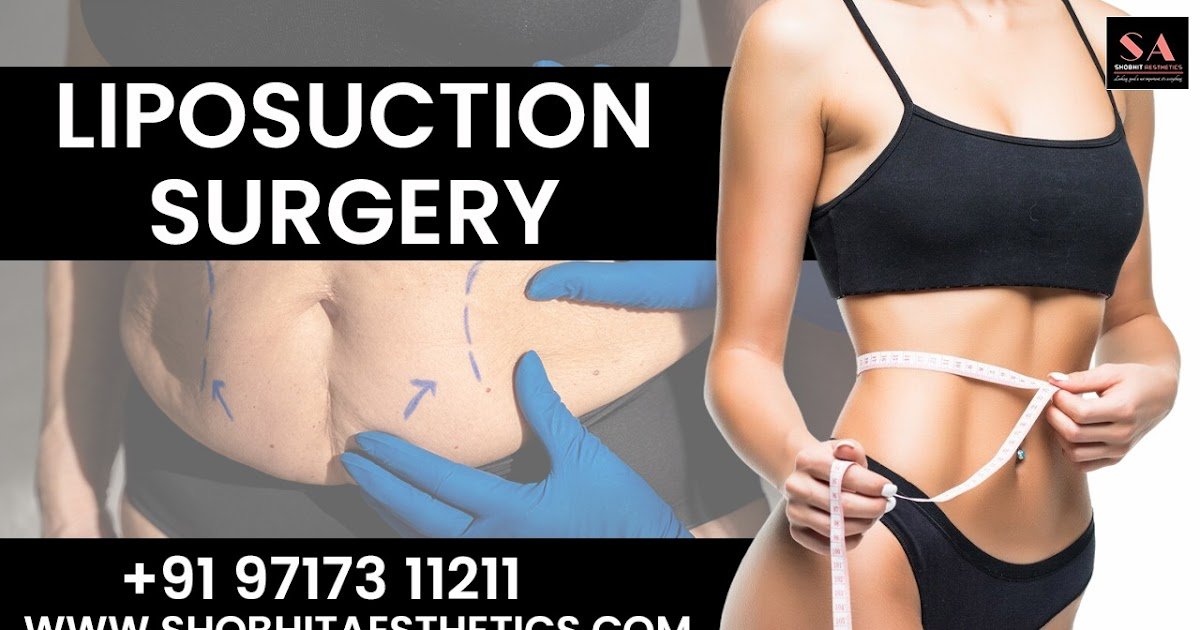 Sculpt Your Dream Body with Confidence: Liposuction Surgery in Delhi